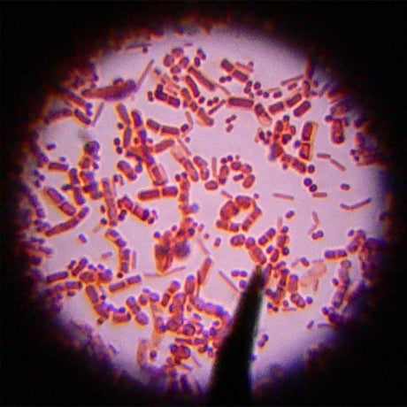 Germs &amp; Us