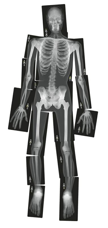 True To Life Human X-Rays
